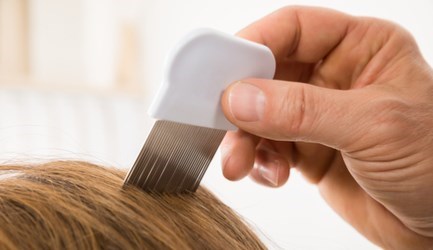 כינים ודרכי טיפול - תמונת המחשה